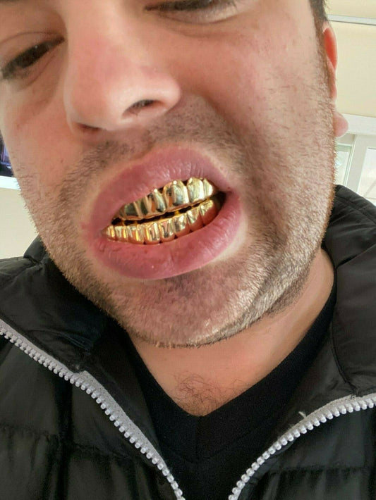 HarlemBling Real 925 Sterling Silver Gold Finish GRILLZ - Hip Hop Grills 6 8 Or Single Teeth