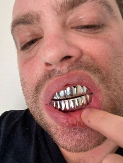 HarlemBling Real 925 Sterling Silver - GRILLZ Top Bottom Hip Hop Grills 6 8 Or Single Teeth